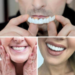 LENTE DE CERÂMICA DENTÁRIA - SMILEFLEX™