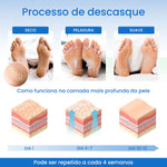 TRATAMENTO COM MEIAS ESFOLIANTES PARA PÉS COM CALOSIDADES - FeetPeel™