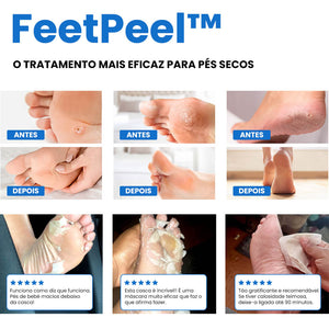 TRATAMENTO COM MEIAS ESFOLIANTES PARA PÉS COM CALOSIDADES - FeetPeel™