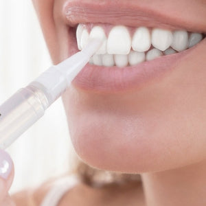 LÁPIS DE BRANQUEAMENTO DENTAL COM FÓRMULA MELHORADA - SMILE WHITE™